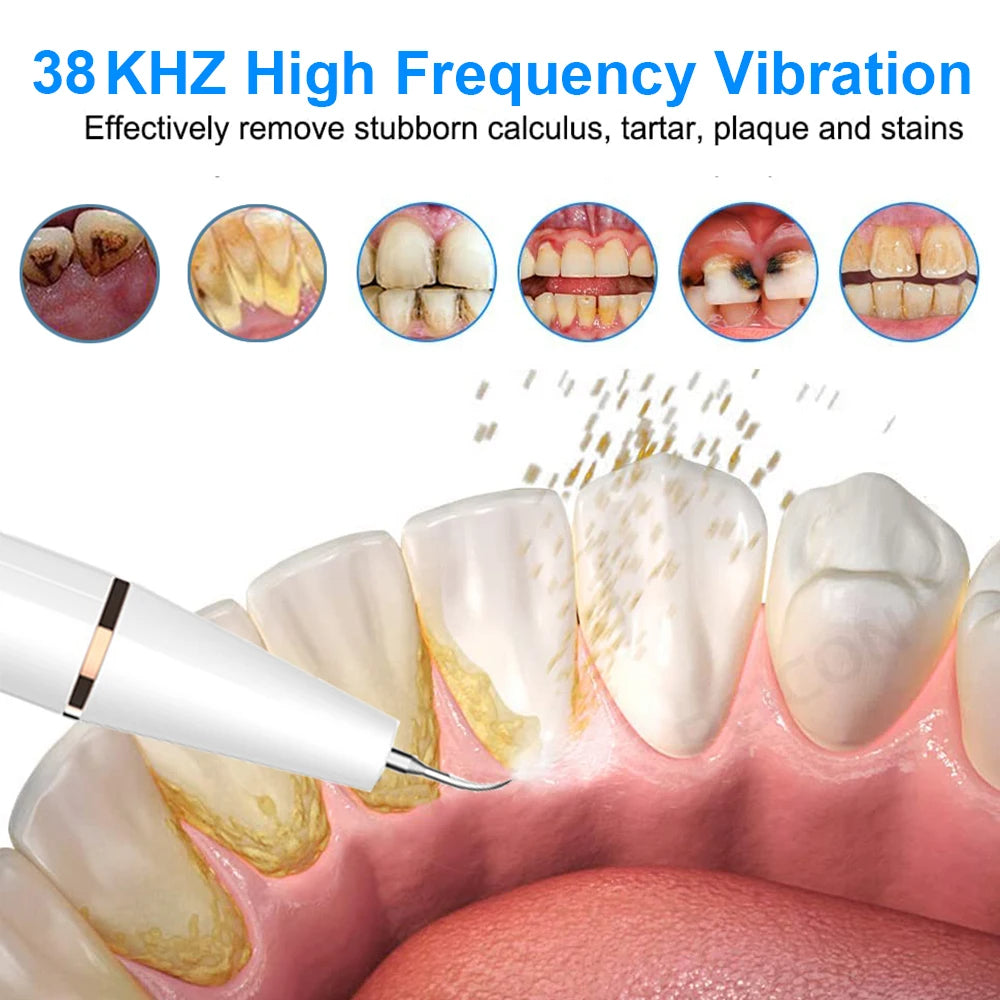 Ultrasonic Dental Teeth Plaque Remover & Cleaner – Sonic Tartar Removal Tool