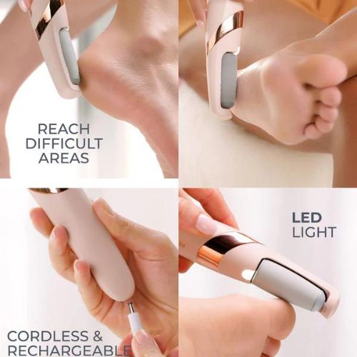 Electric Foot Skin Remover & Callus Sander